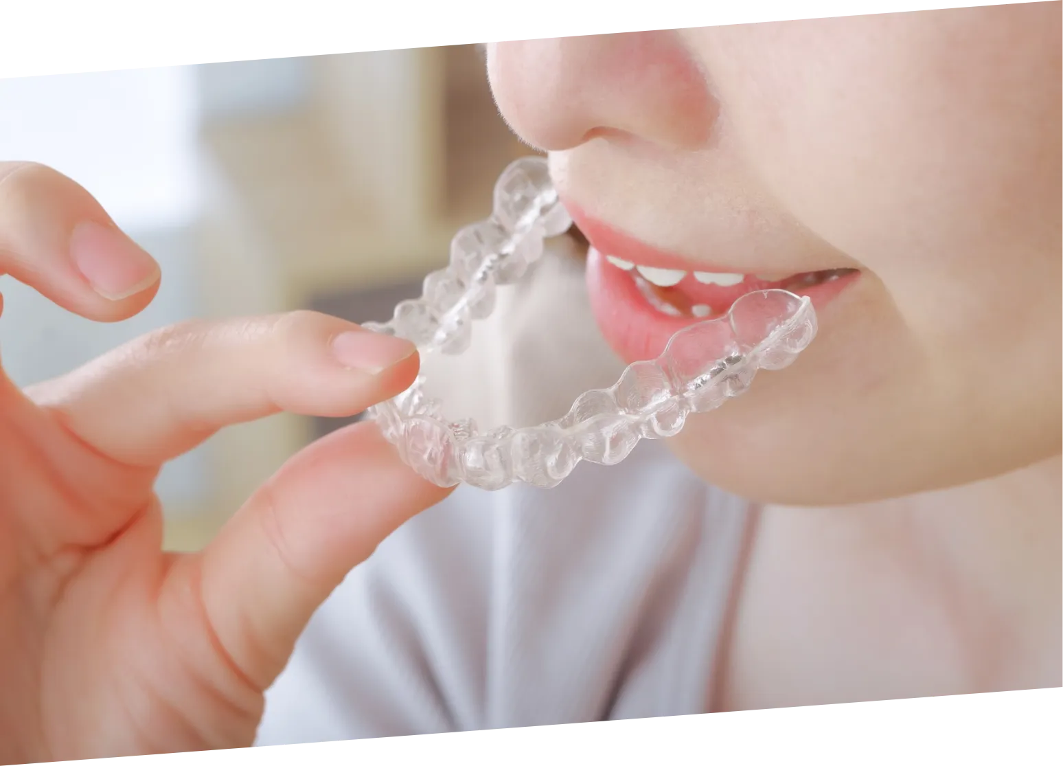 幅広い症例にも対応可能!